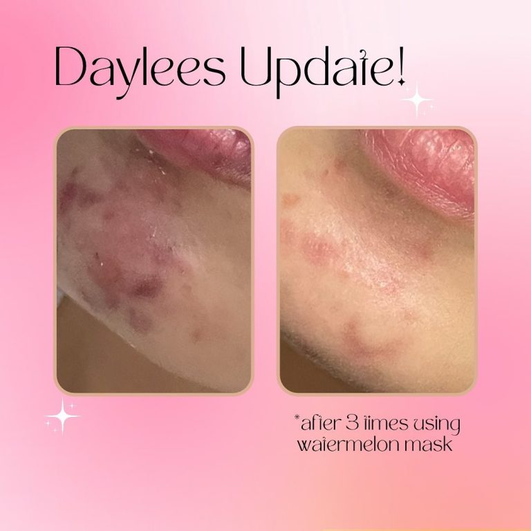 295966377_730198064728831_1961959569883024686_n